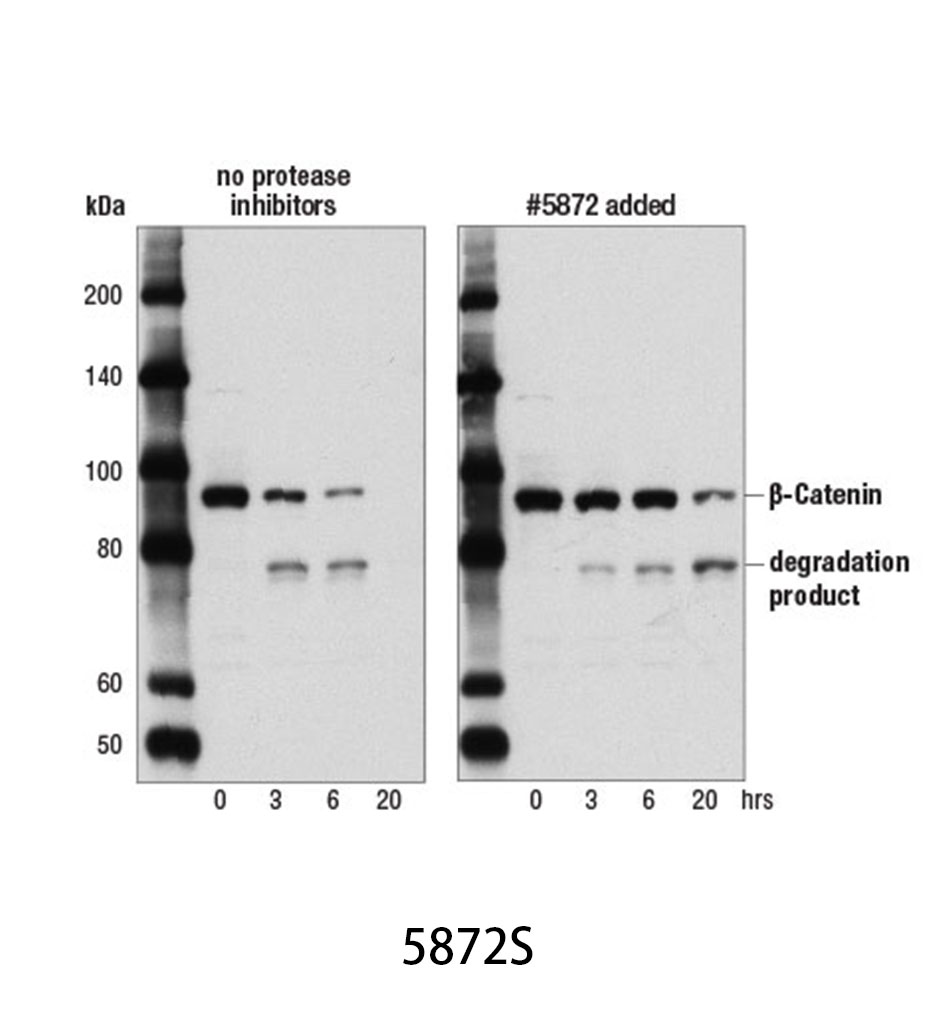 Protease/Phosphatase Inhibitor Cocktail (100X)