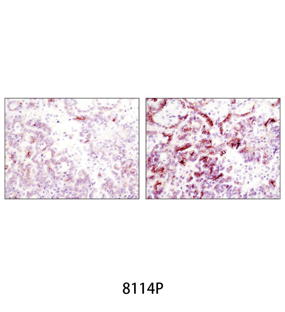 SignalStain Boost IHC Detection Reagent (HRP Rabbit)