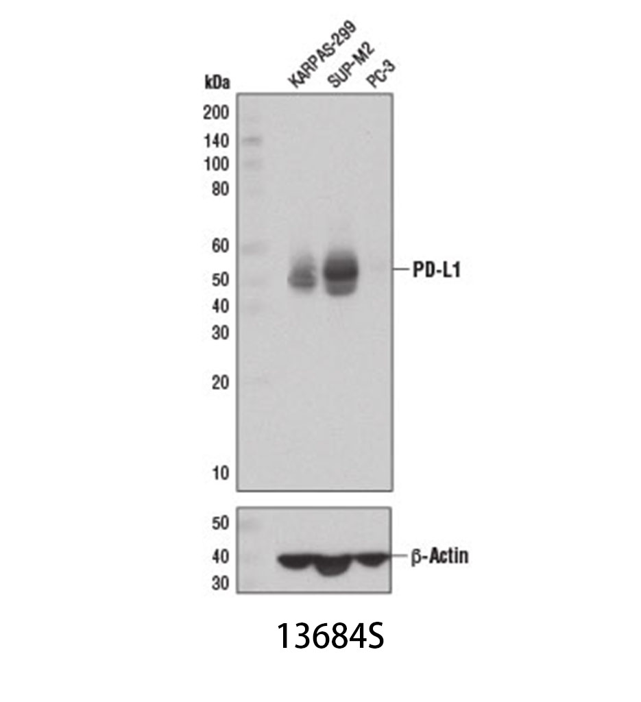 PD-L1 (E1L3N) XP Rabbit mAb