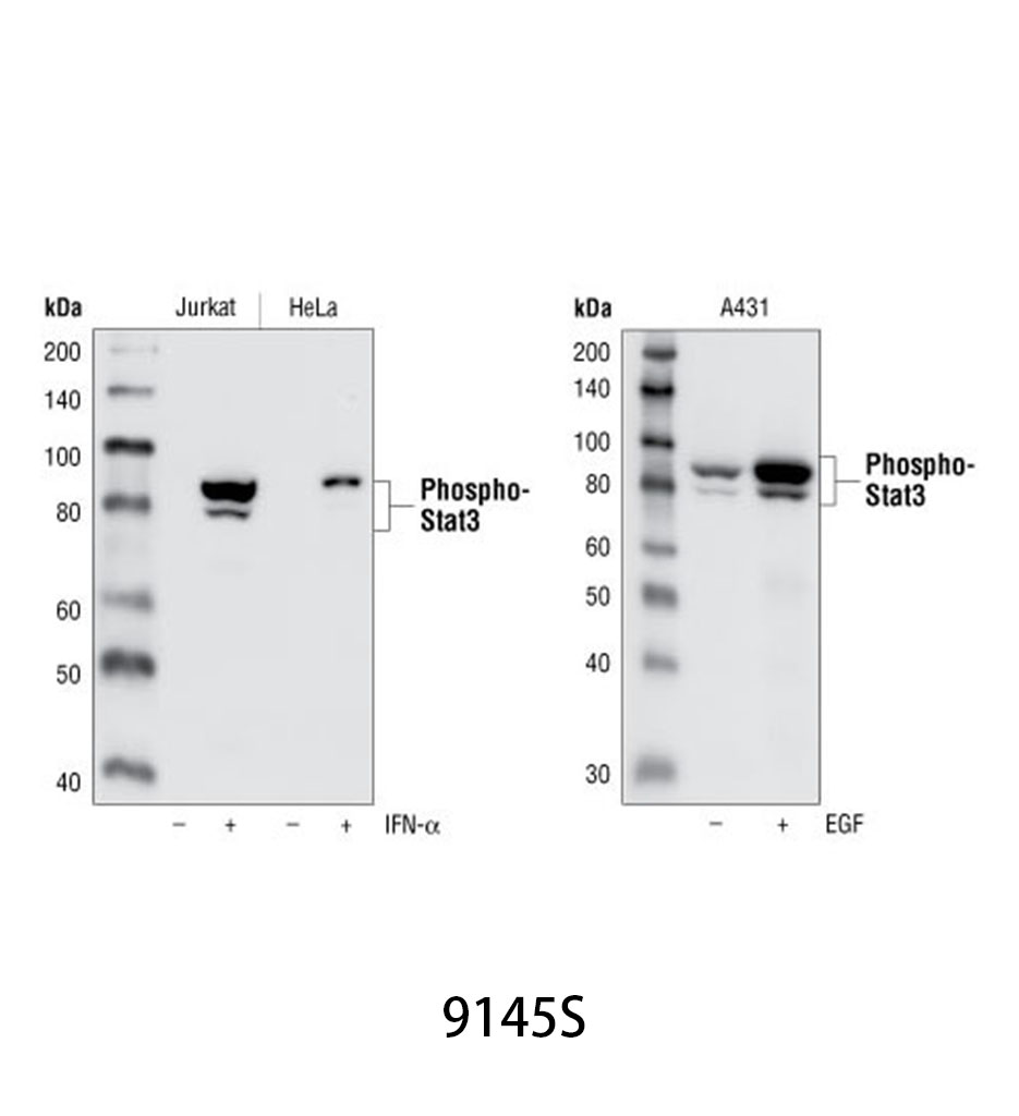 Phospho-Stat3 (Tyr705) (D3A7) XP Rabbit mAb