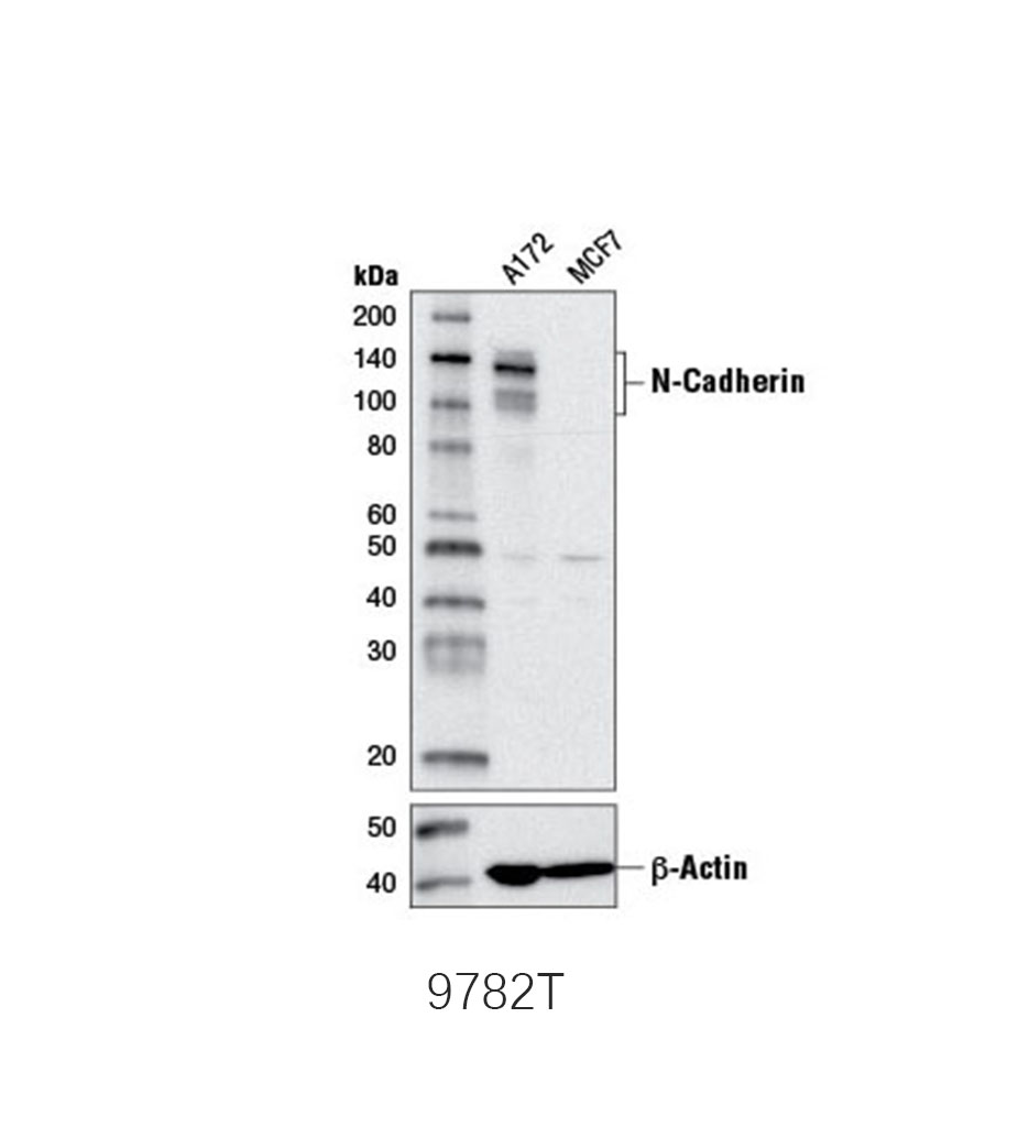 Epithelial-Mesenchymal Transition (EMT) Antibody Sampler Kit