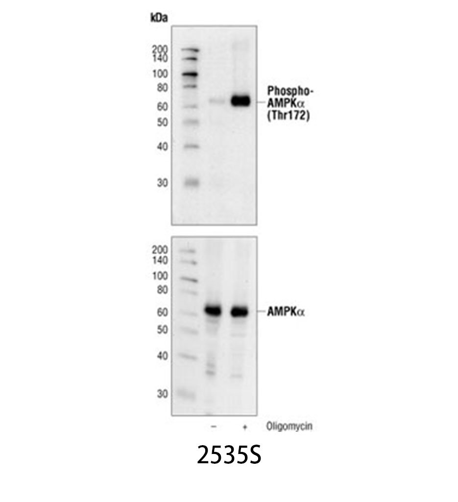Phospho-AMPKα (Thr172) (40H9) Rabbit mAb