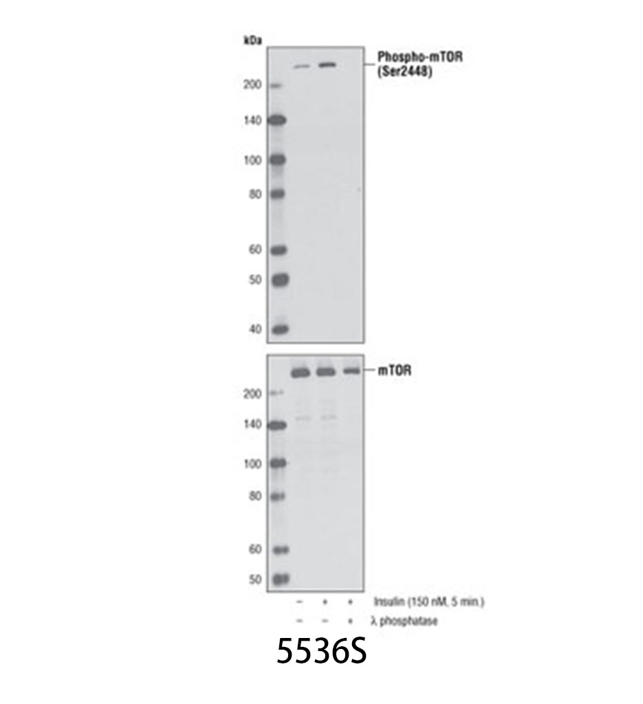 Phospho-mTOR (Ser2448) (D9C2) XP Rabbit mAb