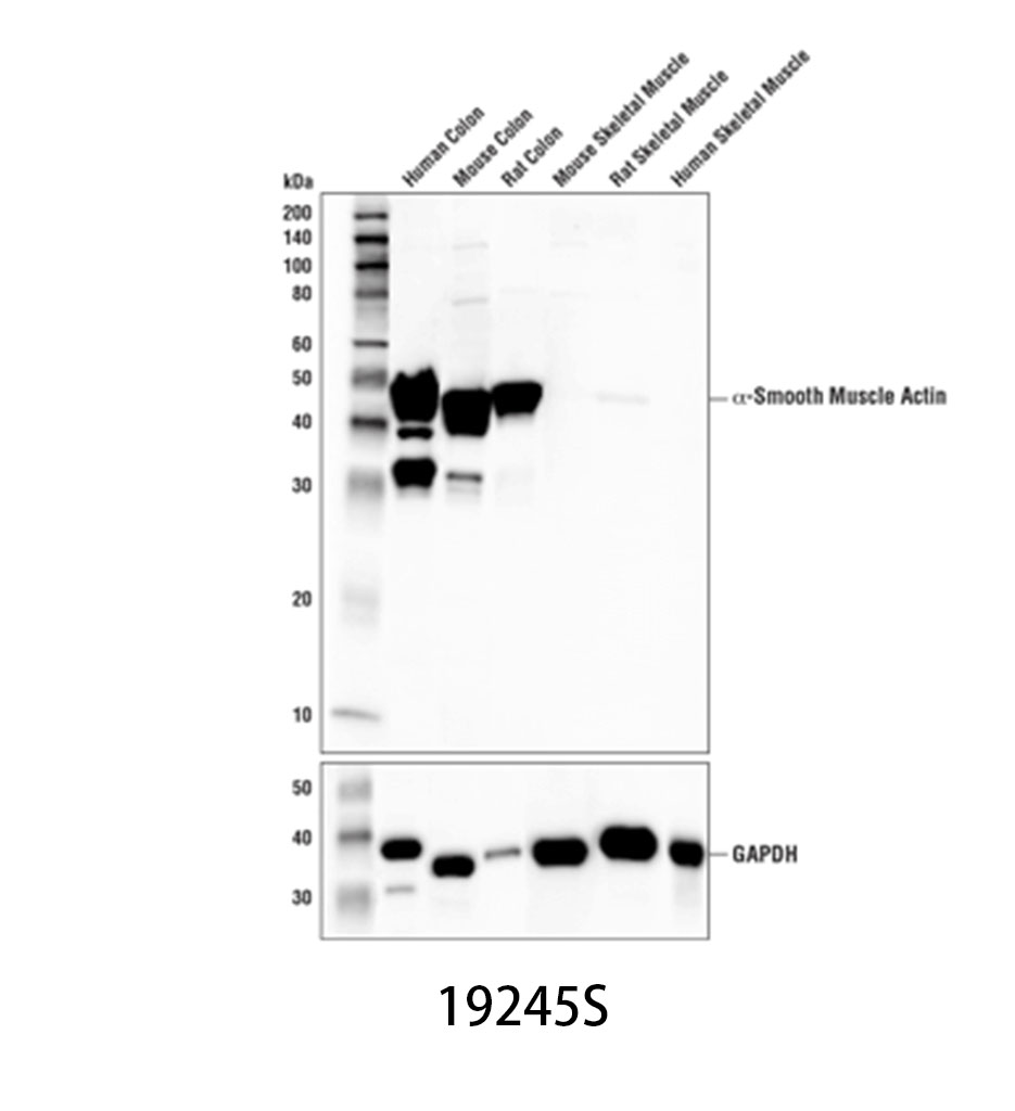 α-Smooth Muscle Actin (D4K9N) XP Rabbit mAb