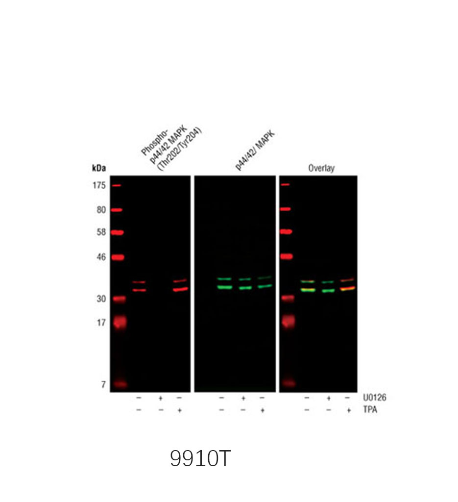 Phospho-MAPK Family Antibody Sampler Kit