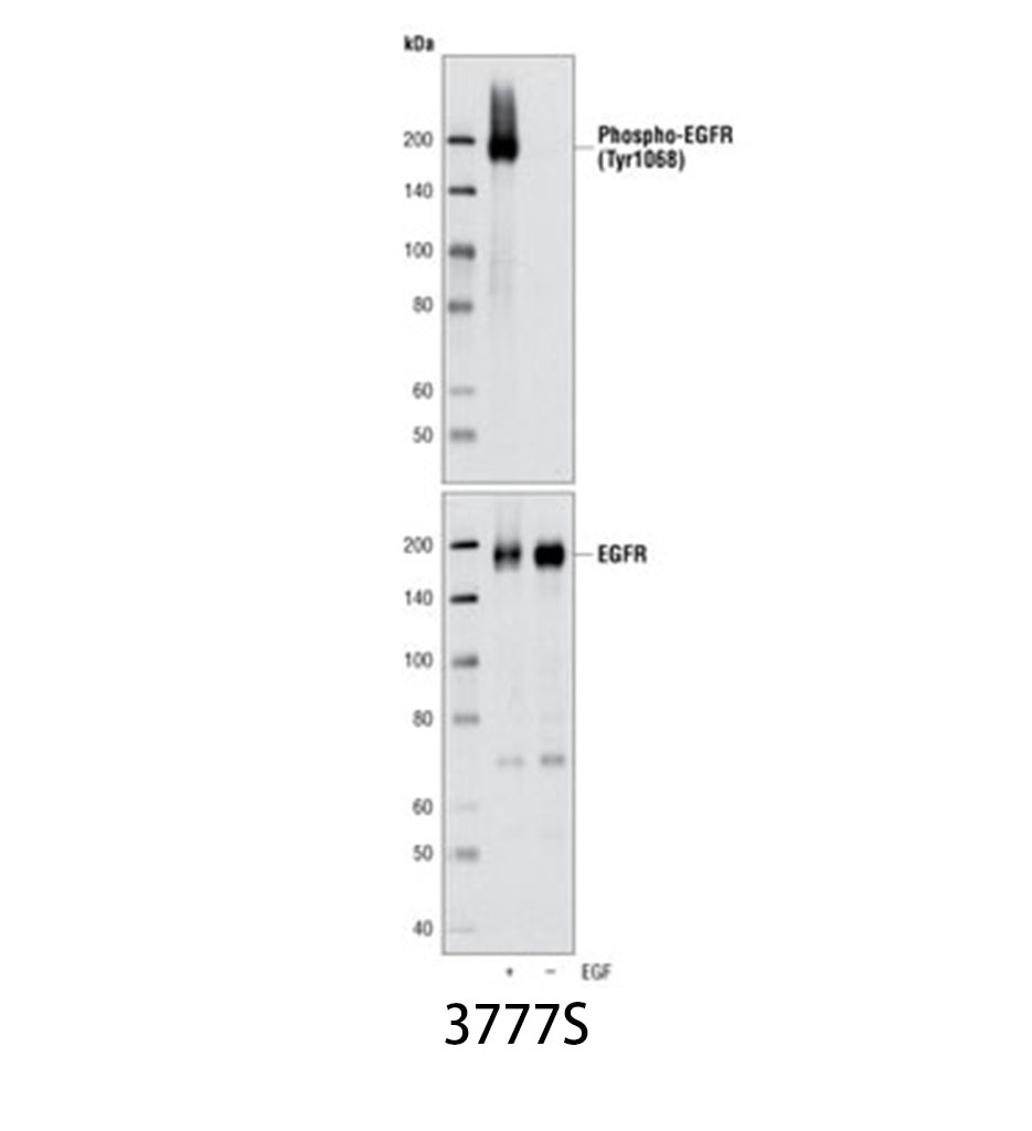 Phospho-EGF Receptor (Tyr1068) (D7A5) XP Rabbit mAb