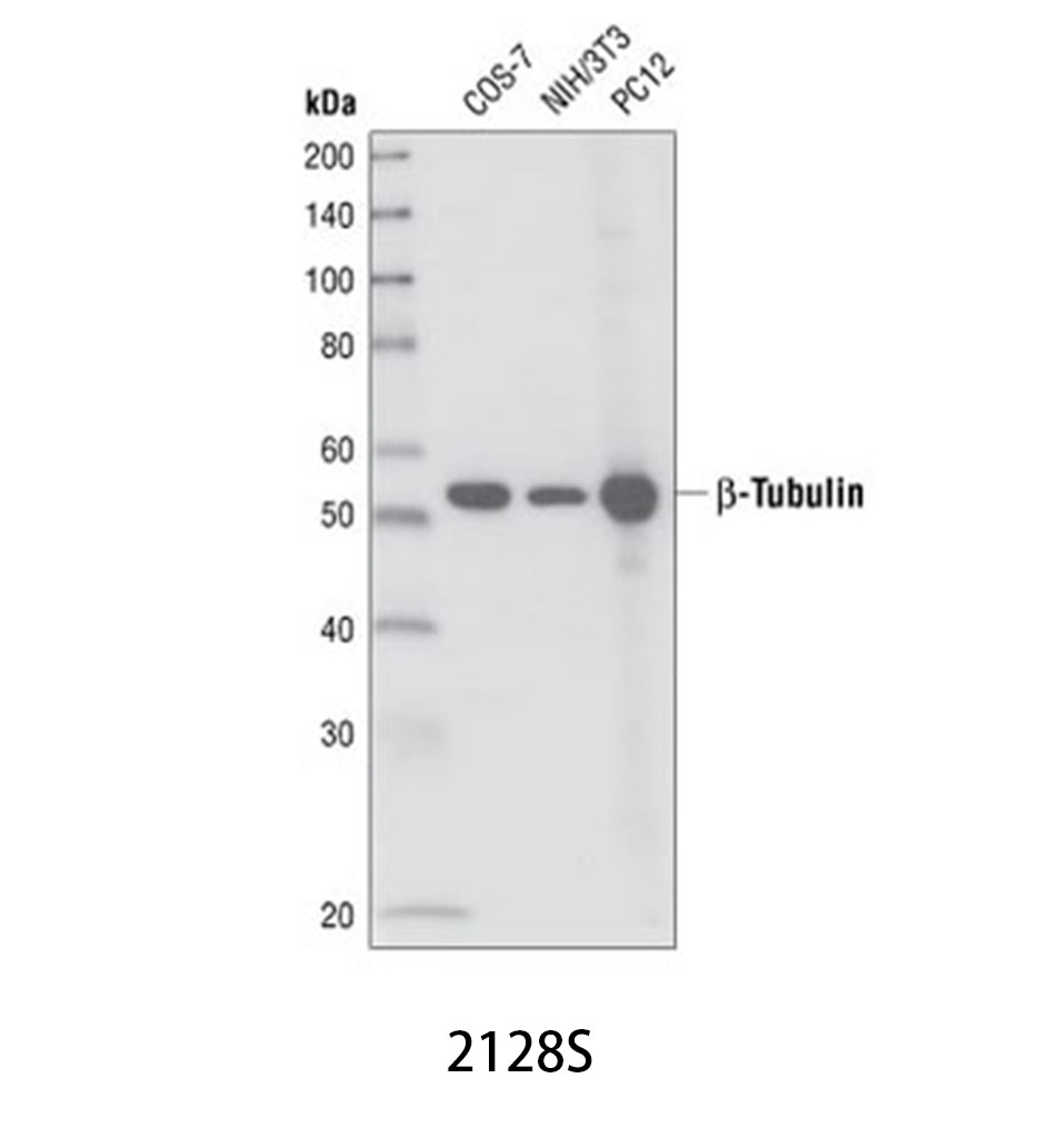 β-Tubulin (9F3) Rabbit mAb