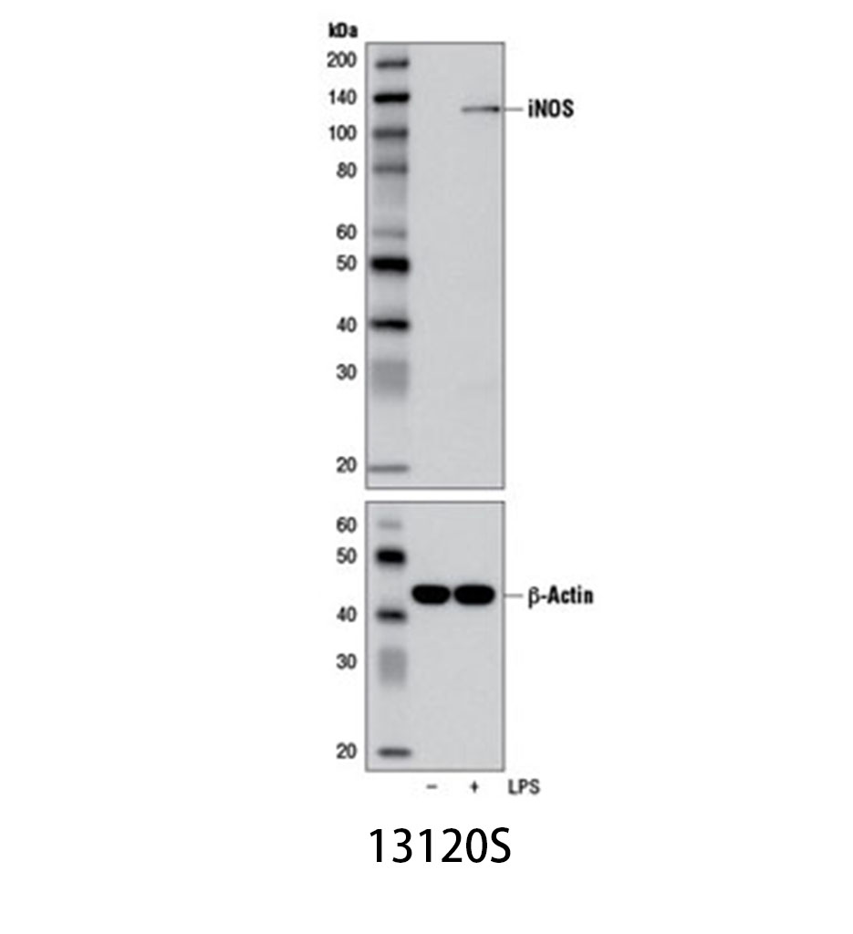 iNOS (D6B6S) Rabbit mAb