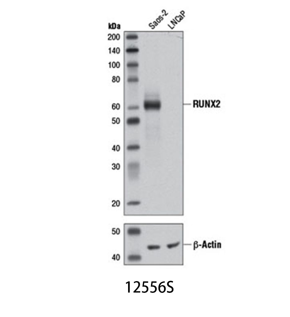 RUNX2 (D1L7F) Rabbit mAb