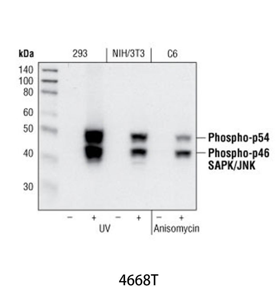 Phospho-SAPK/JNK (Thr183/Tyr185) (81E11) Rabbit mAb