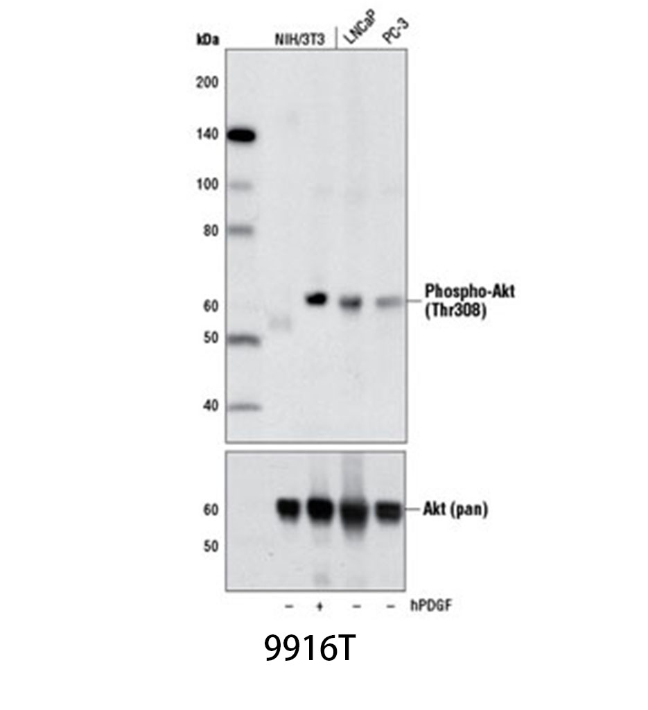 Phospho-Akt Pathway Antibody Sampler Kit