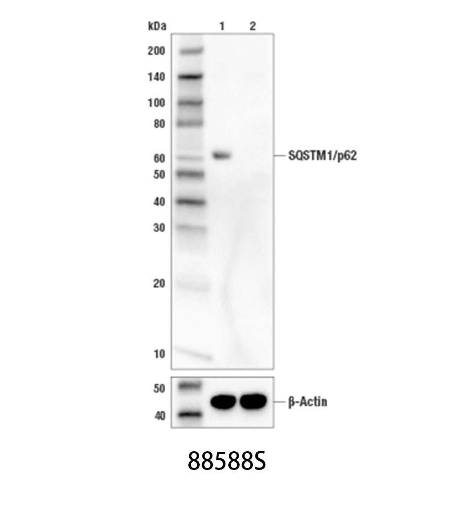 SQSTM1/p62 (D5L7G) Mouse mAb