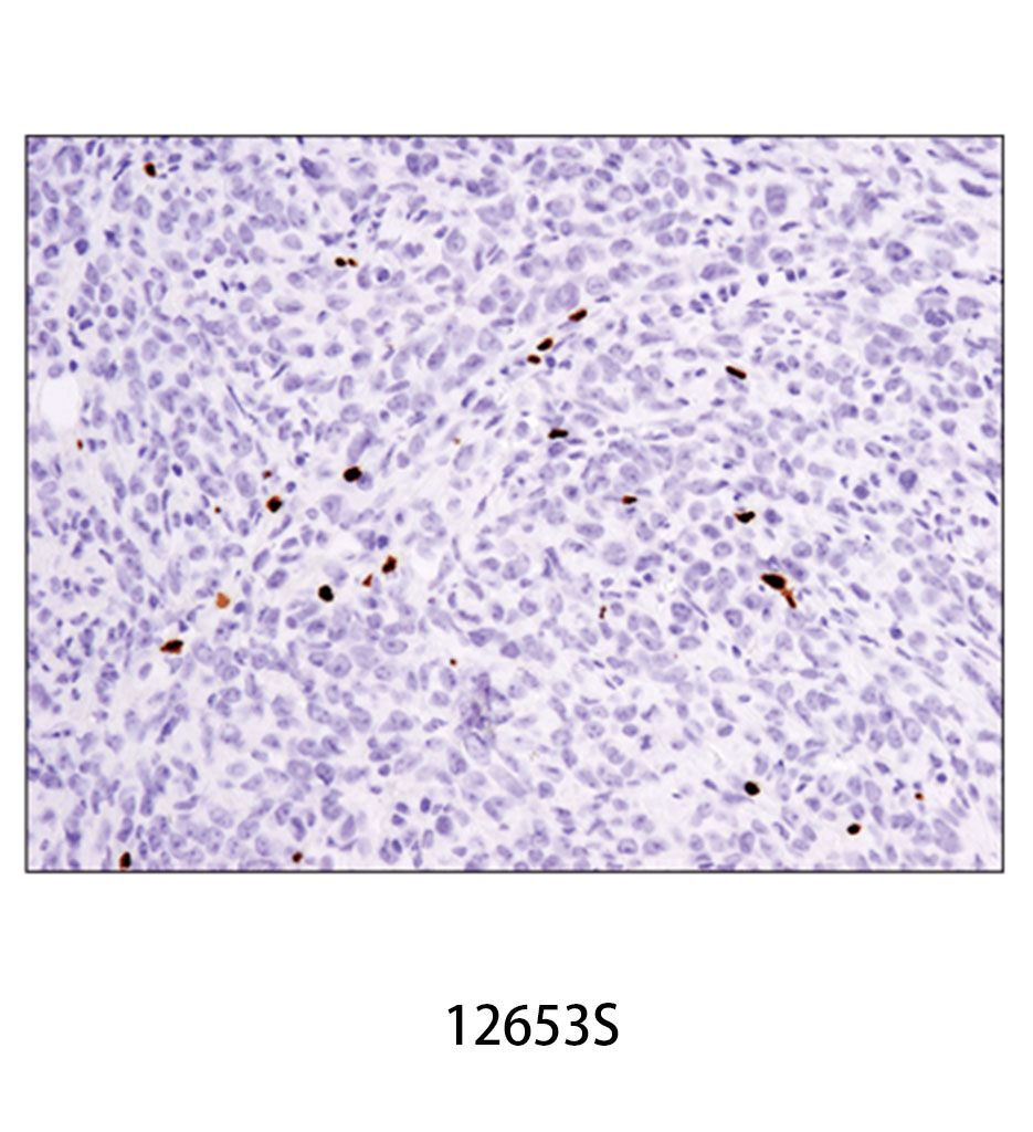 FoxP3 (D6O8R) Rabbit mAb