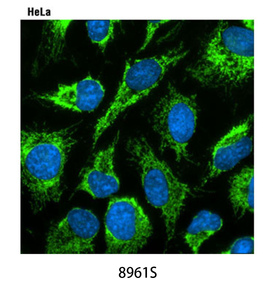 ProLongGold Antifade Reagent with DAPI