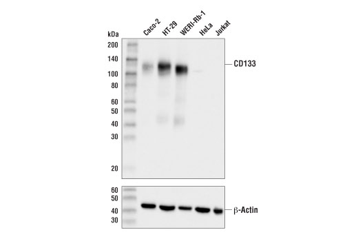 CD133 (D2V8Q) XP Rabbit mAb