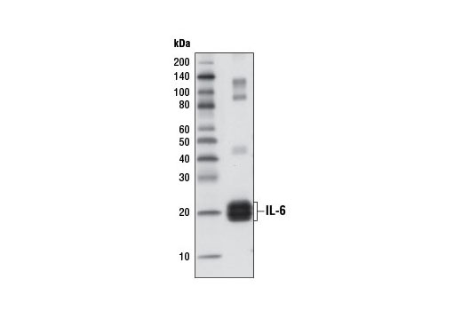 IL-6 (D3K2N) Rabbit mAb