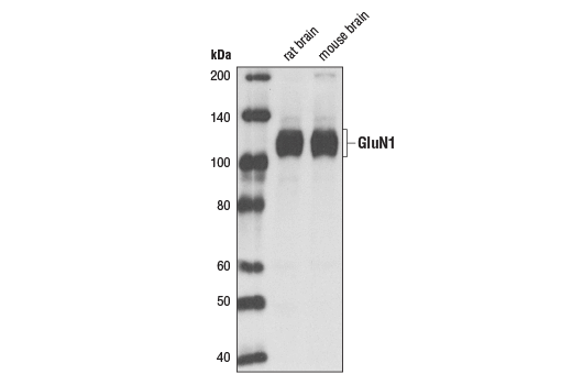 NMDA Receptor 1 (GluN1) (D65B7) Rabbit mAb