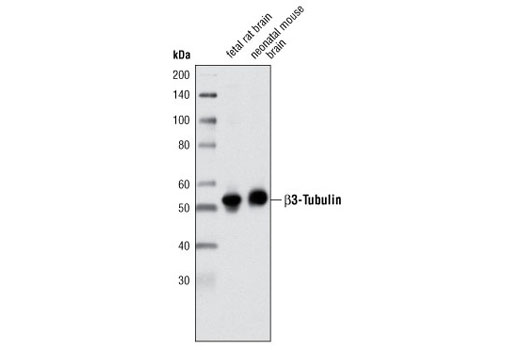 β3-Tubulin (TU-20) Mouse mAb