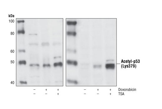 Acetyl-p53 (Lys379) Antibody