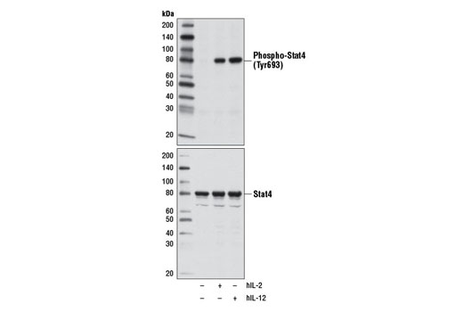 Phospho-Stat4 (Tyr693) (D2E4) Rabbit mAb