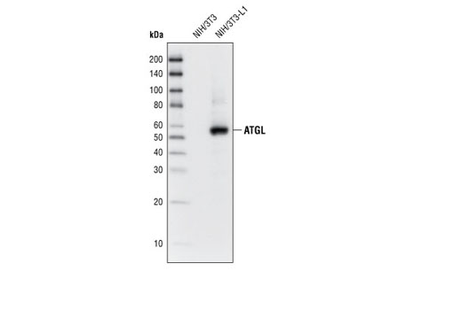 ATGL (30A4) Rabbit mAb