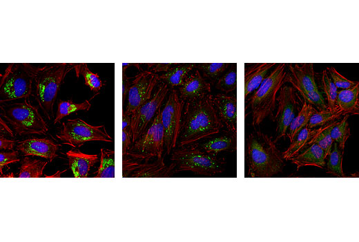 LC3A/B (D3U4C) XP Rabbit mAb (Alexa Fluor488 Conjugate)