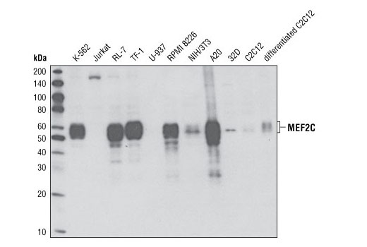 MEF2C (D80C1) XP Rabbit mAb