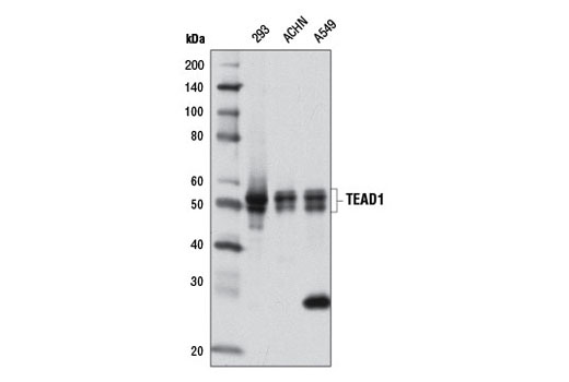 TEAD1 (D9X2L) Rabbit mAb