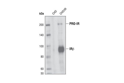Insulin Receptor β (L55B10) Mouse mAb