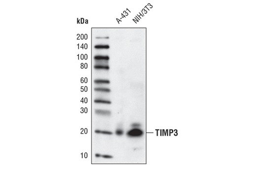 TIMP3 (D74B10) Rabbit mAb
