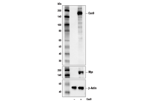Cas9 (<i>S. pyogenes</i>) (D8Y4K) Rabbit mAb