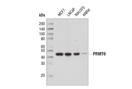 PRMT6 (D5A2N) Rabbit mAb
