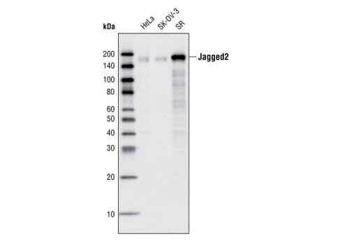 Jagged2 (C23D2) Rabbit mAb