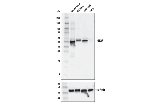 GFAP (E6N9L) Mouse mAb