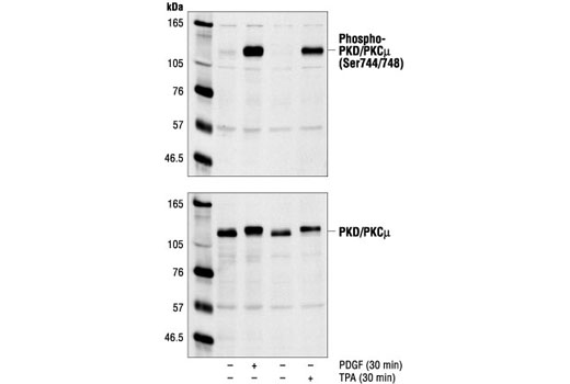 Phospho-PKD/PKCμ (Ser744/748) Antibody