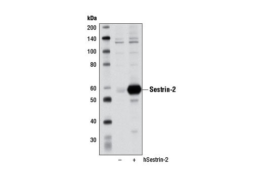 Sestrin-2 (D1B6) Rabbit mAb