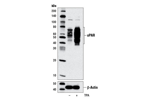 uPAR (D7X2N) Rabbit mAb