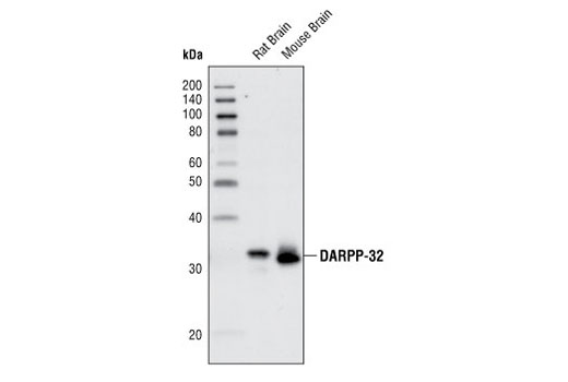 DARPP-32 (19A3) Rabbit mAb