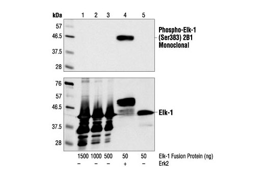 Phospho-Elk-1 (Ser383) (2B1) Mouse mAb