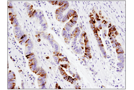 MUC5AC (E3O9I) XP Rabbit mAb