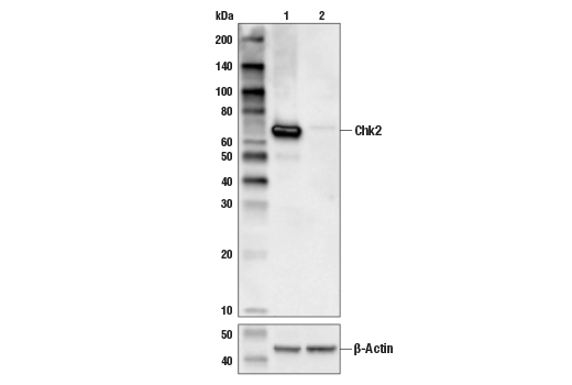 Chk2 (D9C6) XP Rabbit mAb