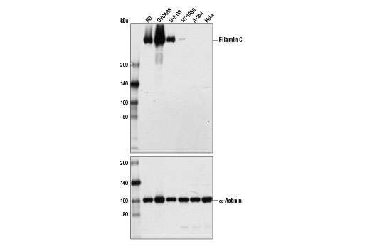 Filamin C (D1K3J) Rabbit mAb