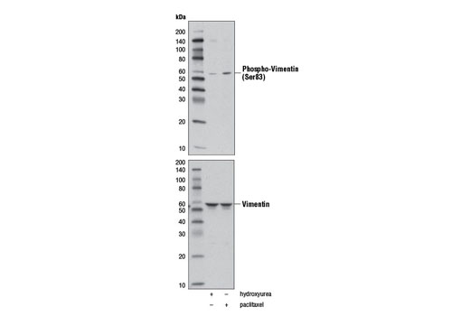 Phospho-Vimentin (Ser83) (D5A2D) Rabbit mAb