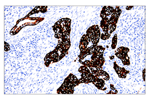 Keratin 5 (E2T4B) XP Rabbit mAb (IHC Preferred)