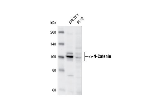 α-N-Catenin Antibody