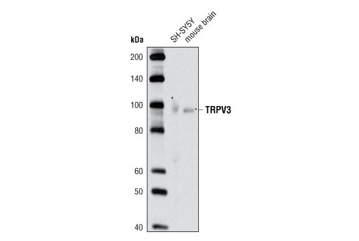TRPV3 Antibody