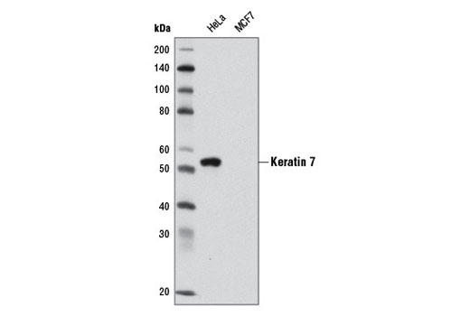 Cytokeratin Antibody Sampler Kit
