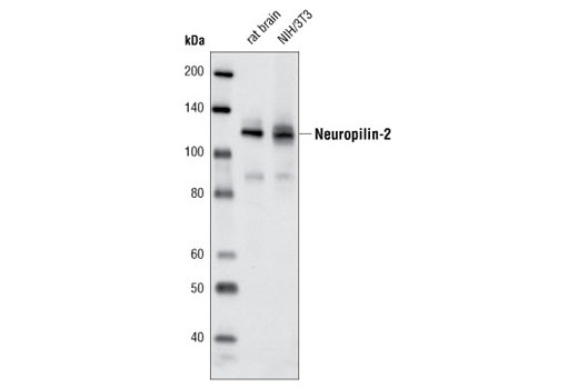 Neuropilin-2 (D39A5) XP Rabbit mAb
