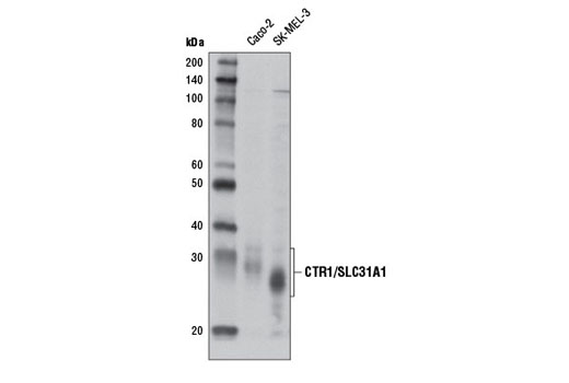 CTR1/SLC31A1 Antibody