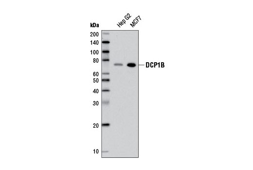 DCP1B (D2P9W) Rabbit mAb